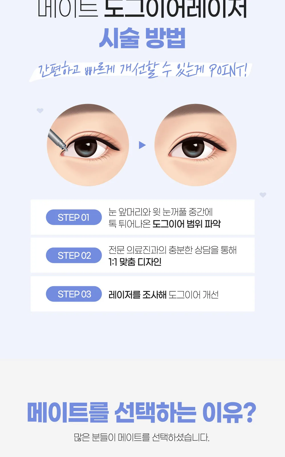 시술 상세 6