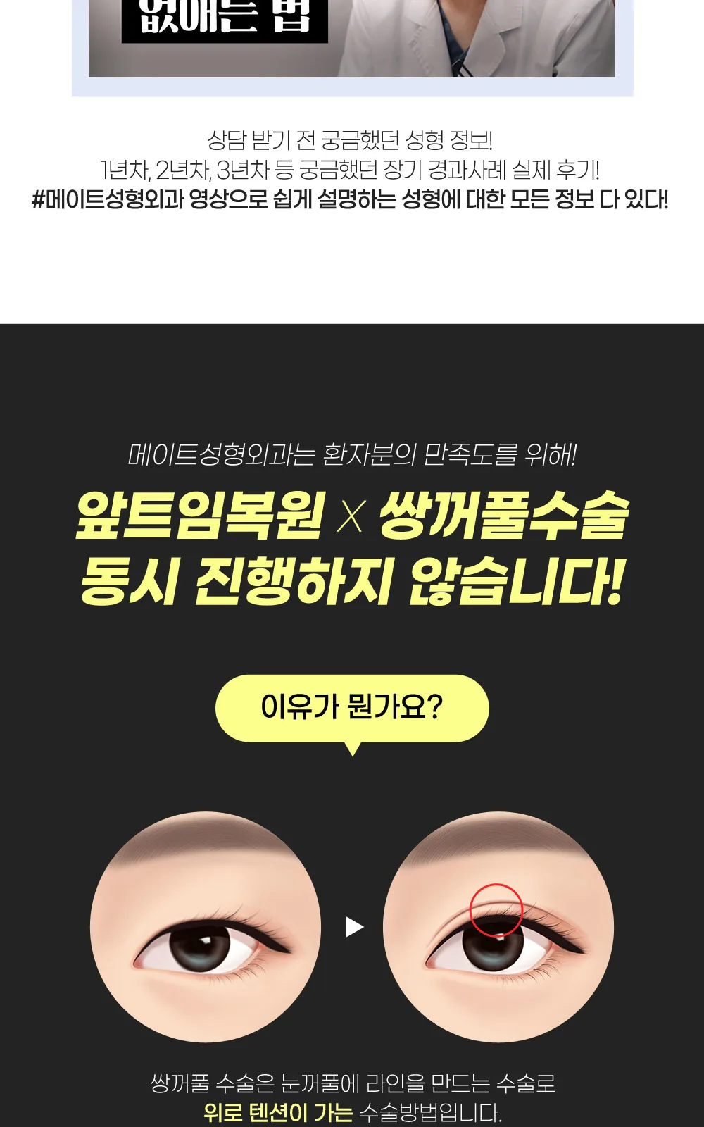 시술 상세 8