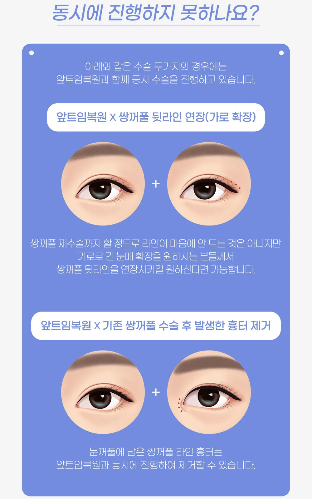시술 상세 11