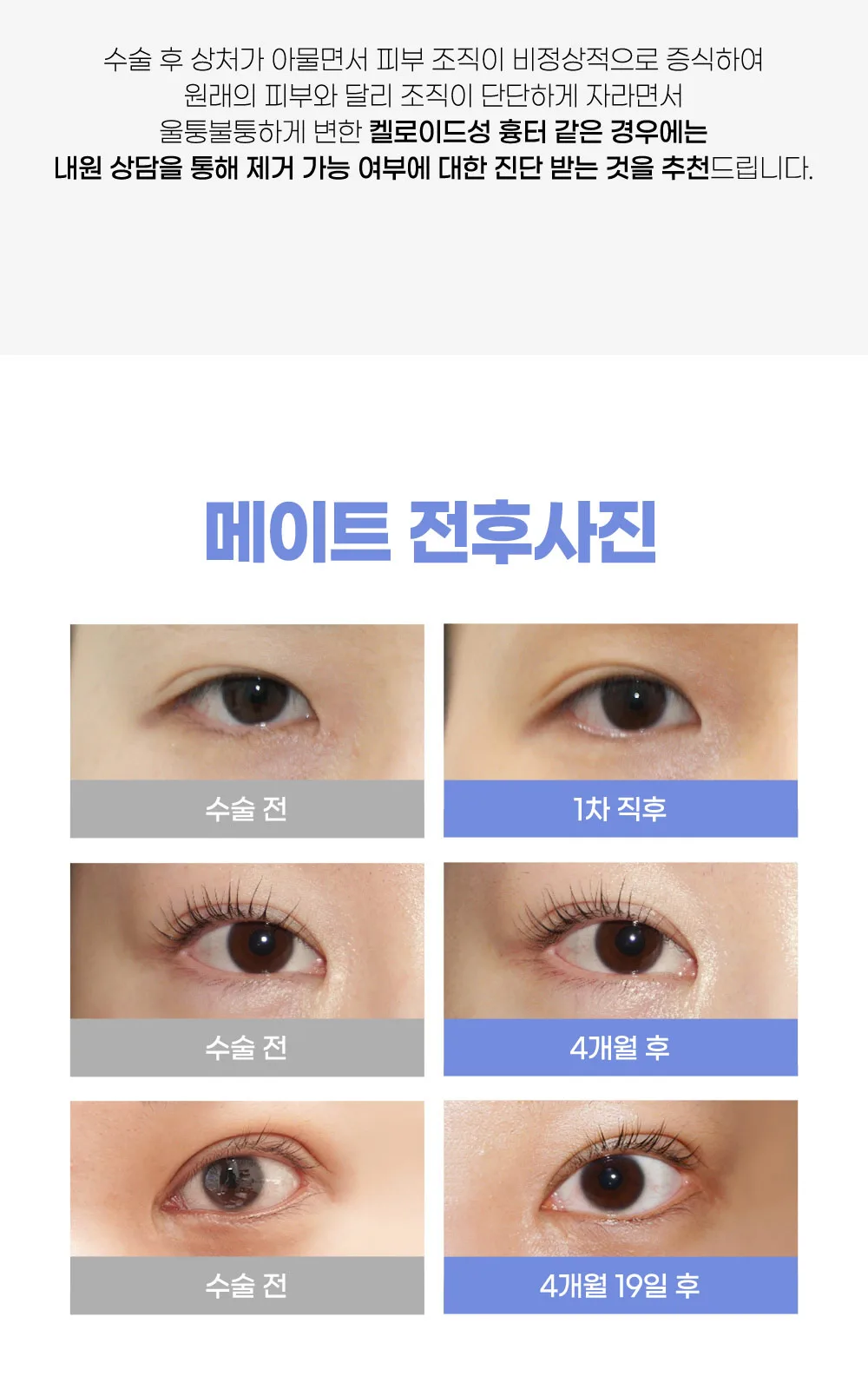 시술 상세 12