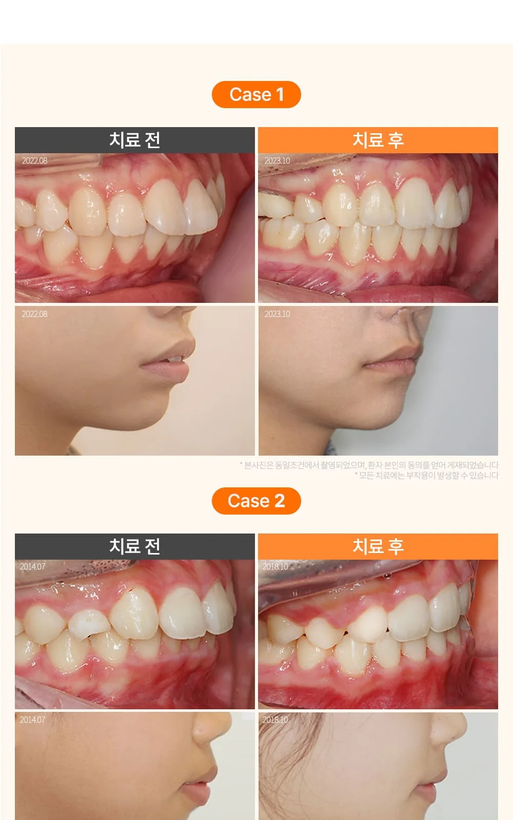 시술 상세 22