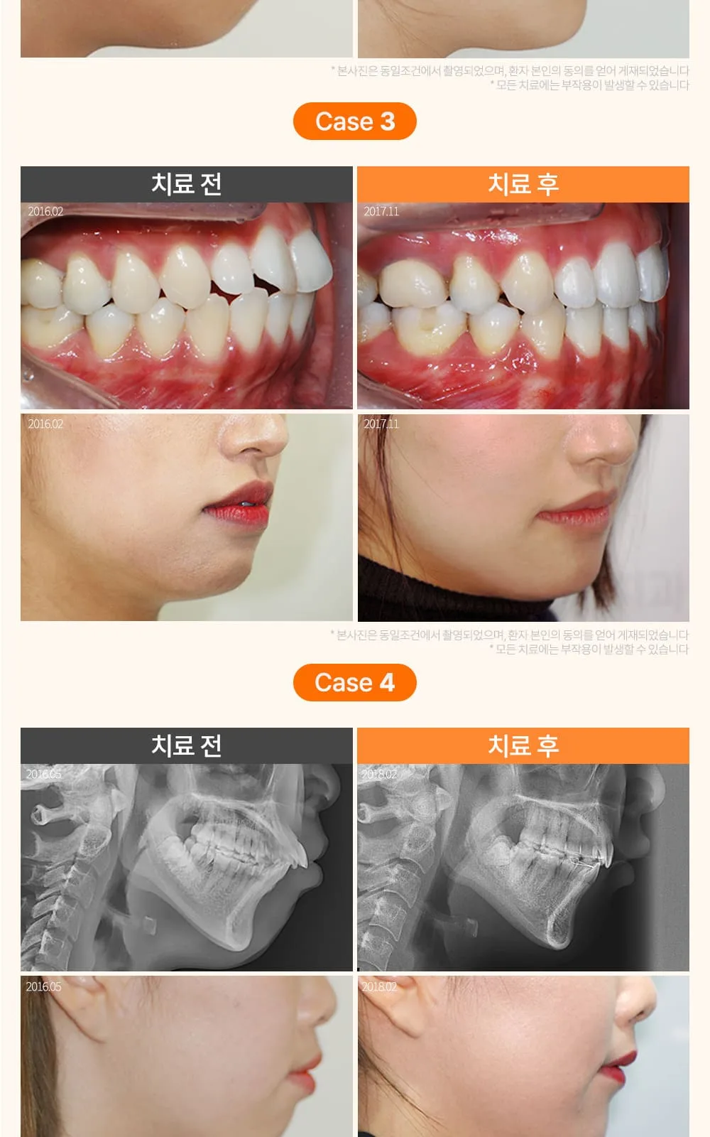 시술 상세 23