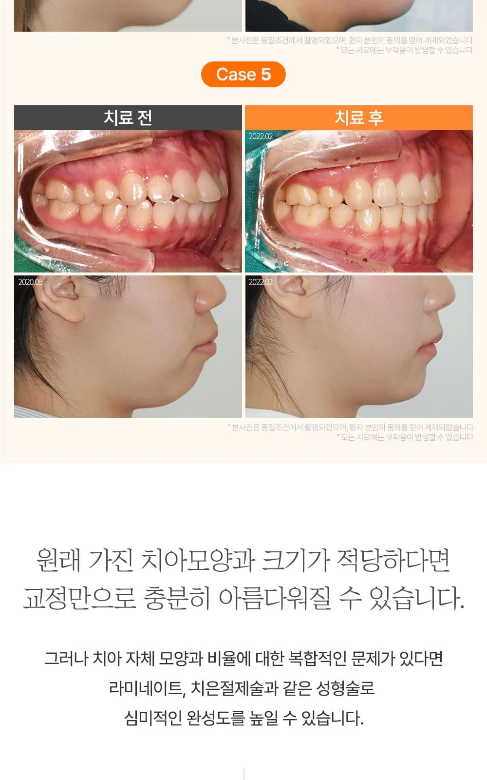 시술 상세 24