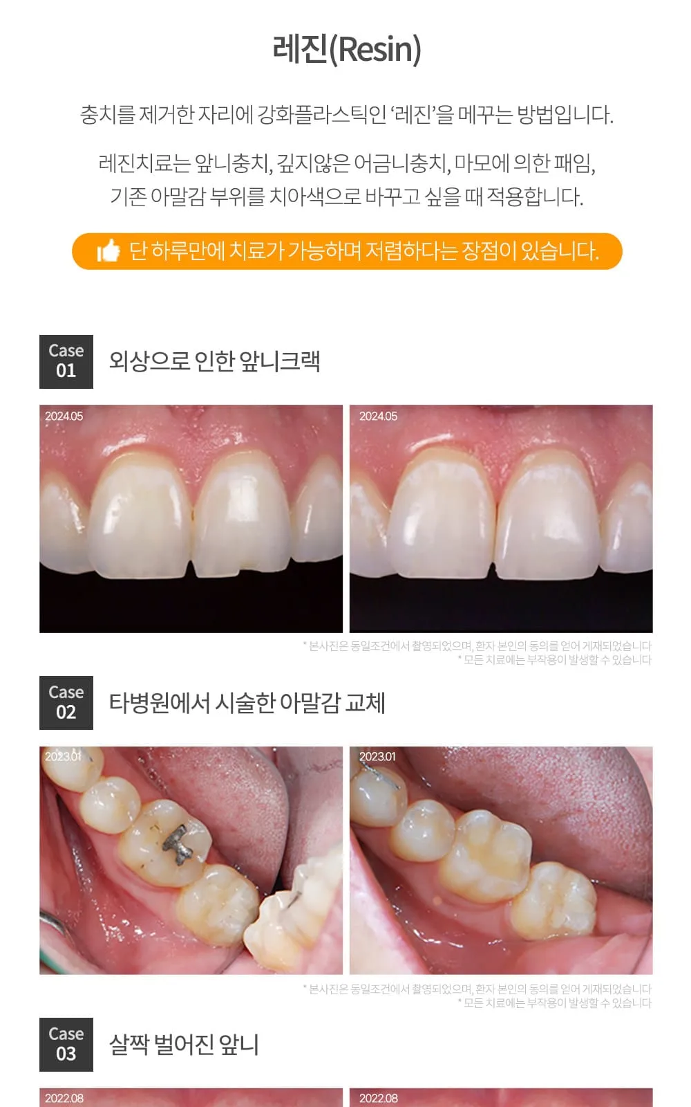 시술 상세 7