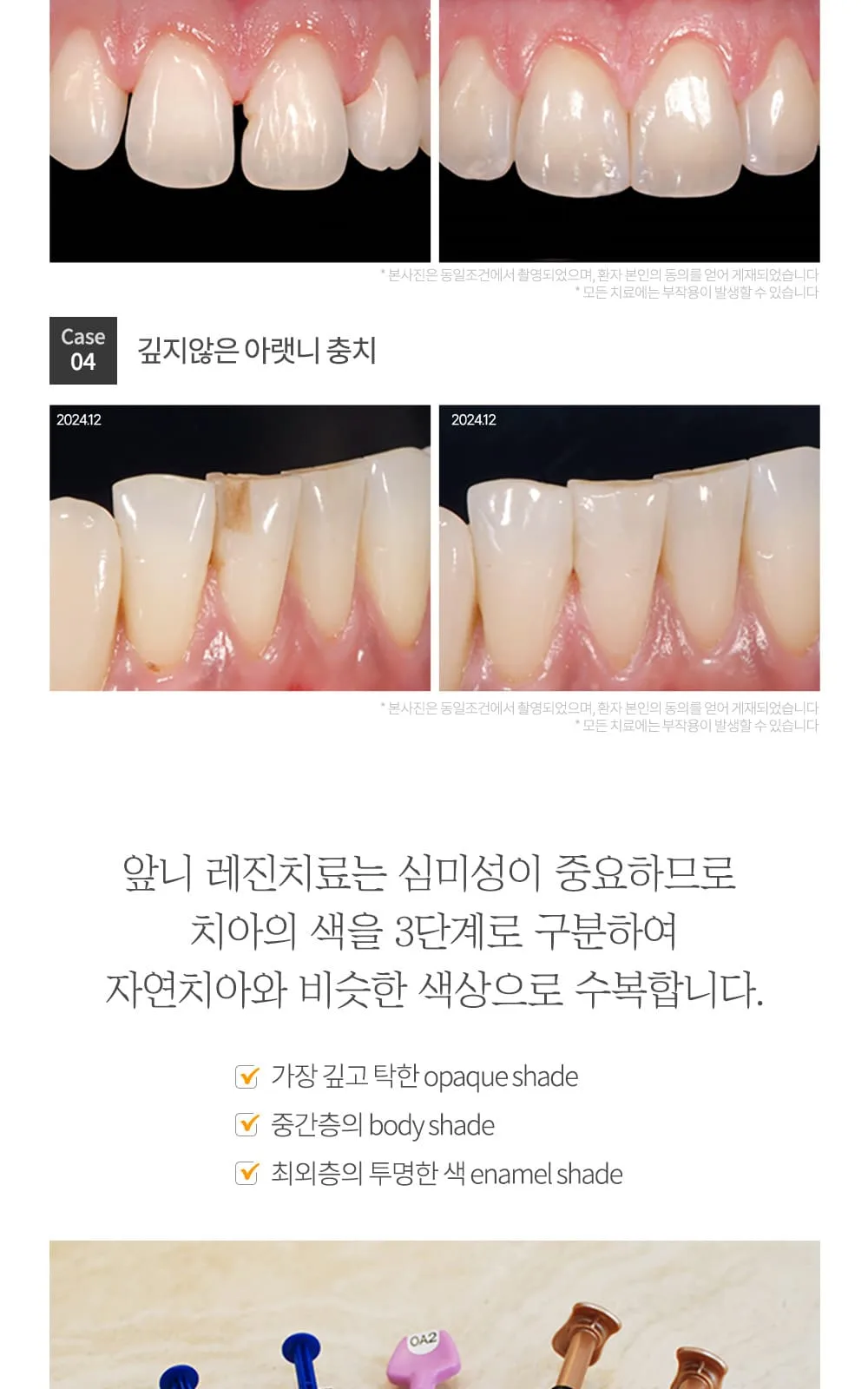 시술 상세 8