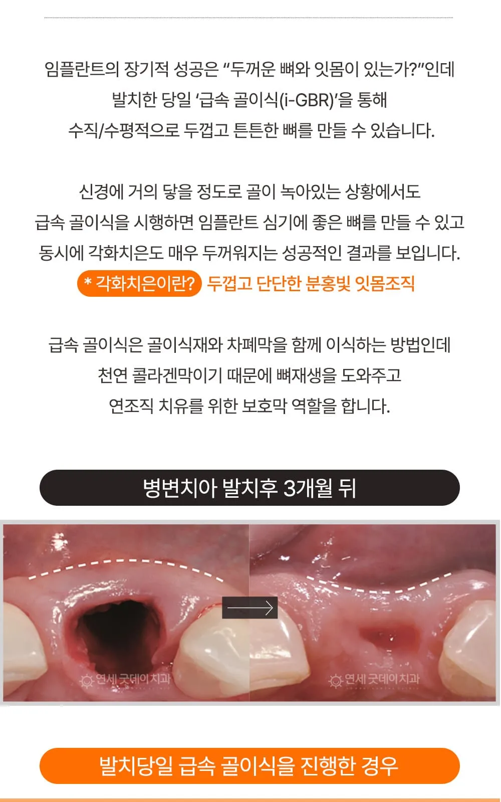 시술 상세 11