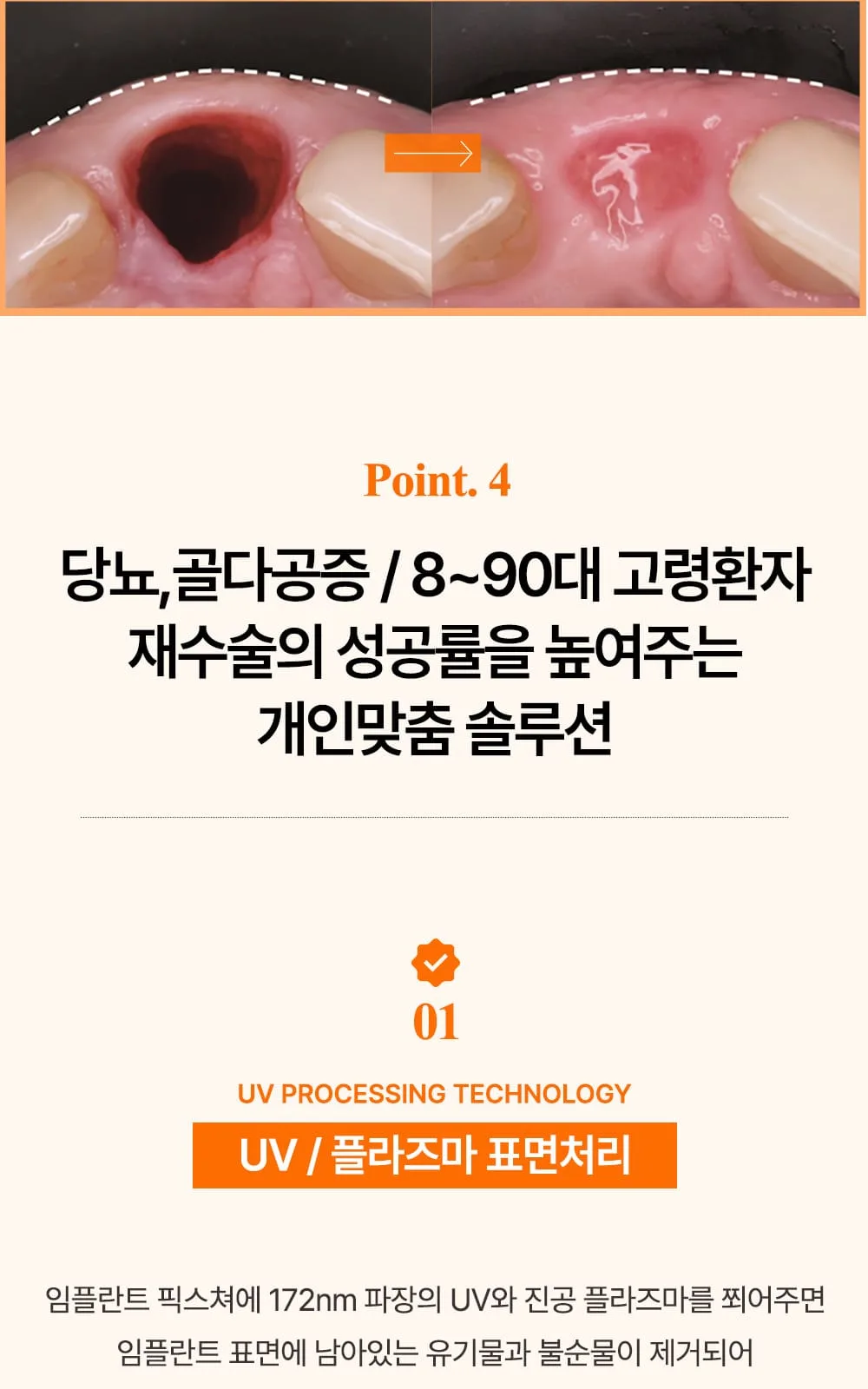 시술 상세 12