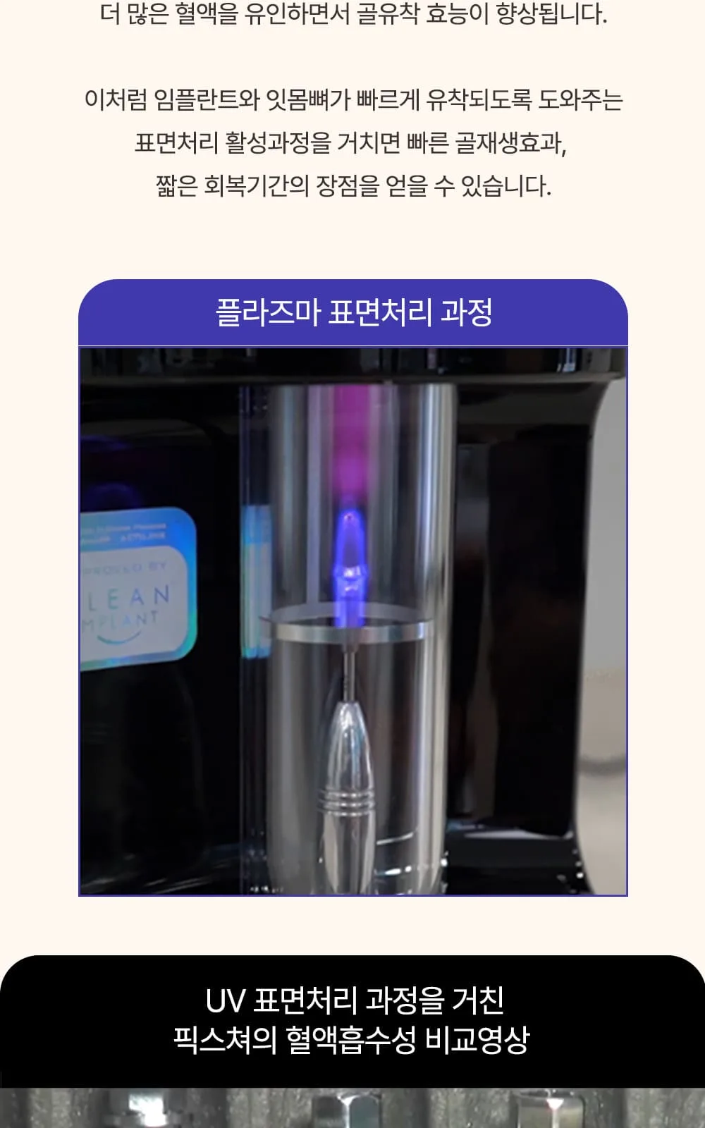 시술 상세 13