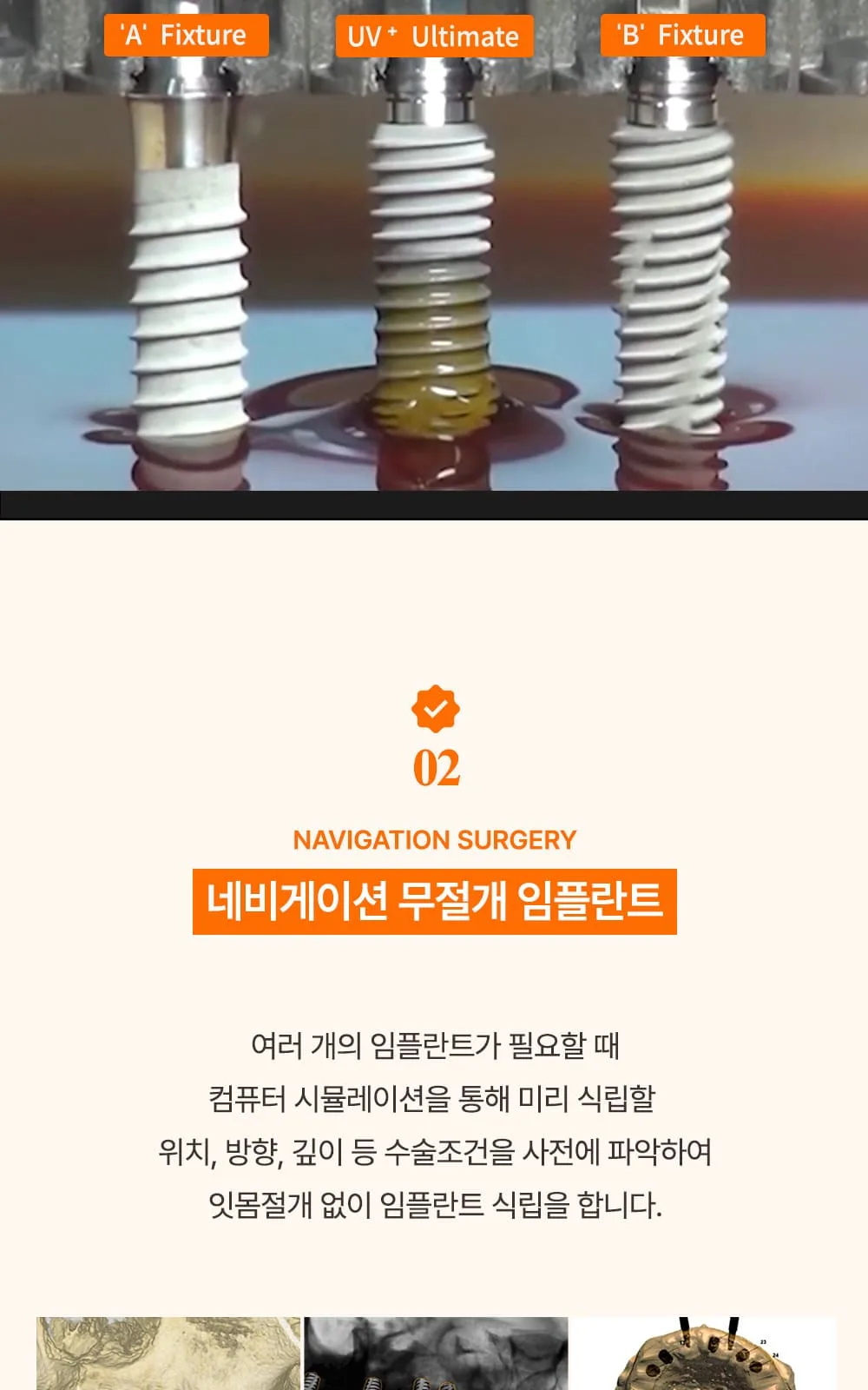 시술 상세 14
