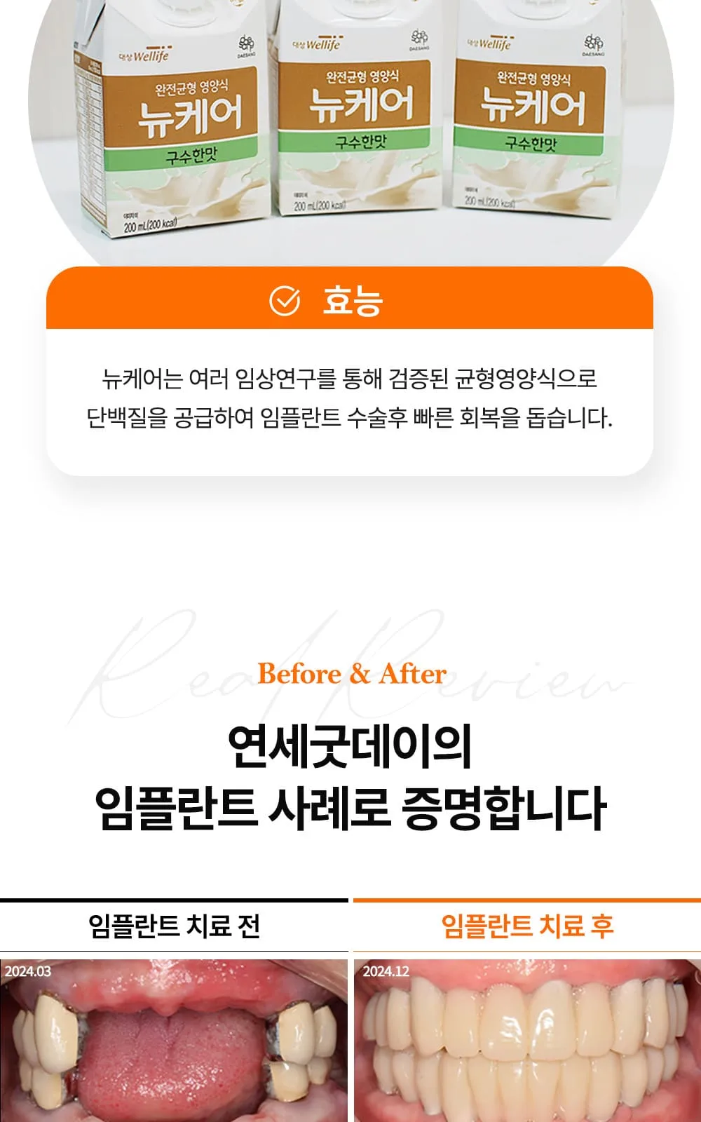 시술 상세 20