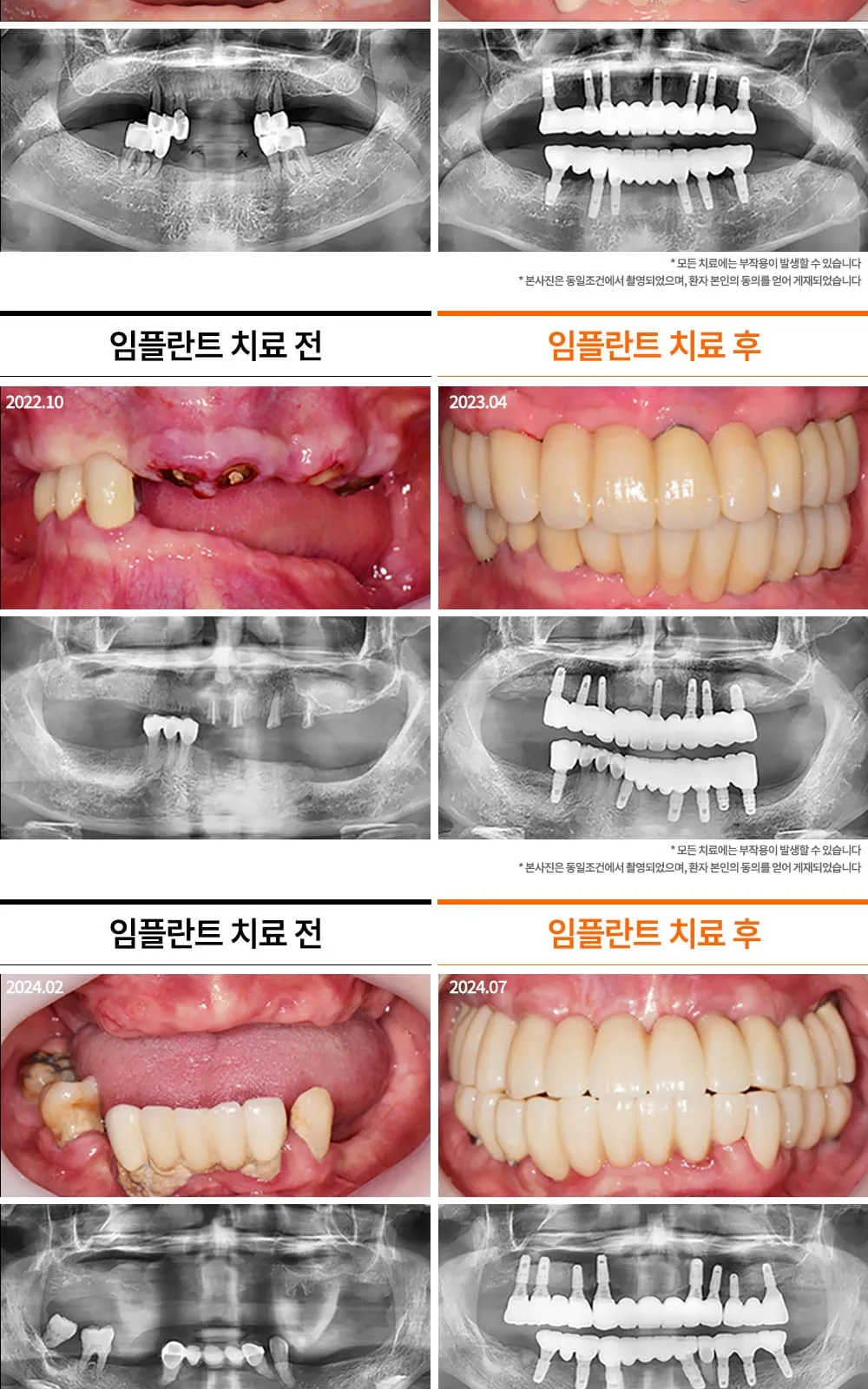 시술 상세 21