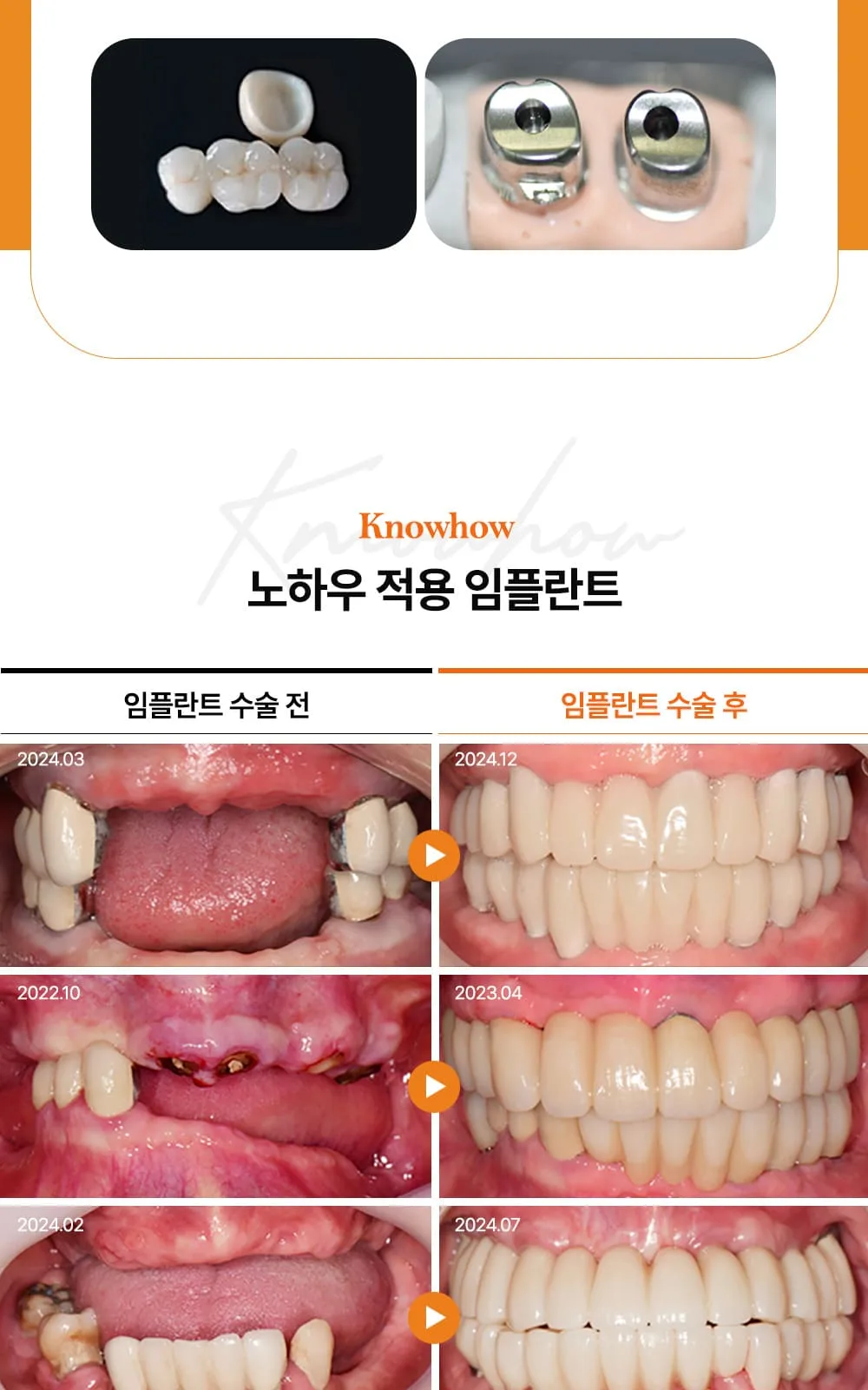 시술 상세 11