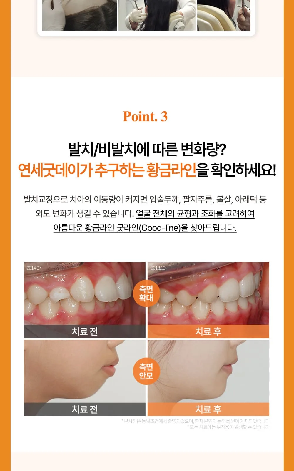 시술 상세 17