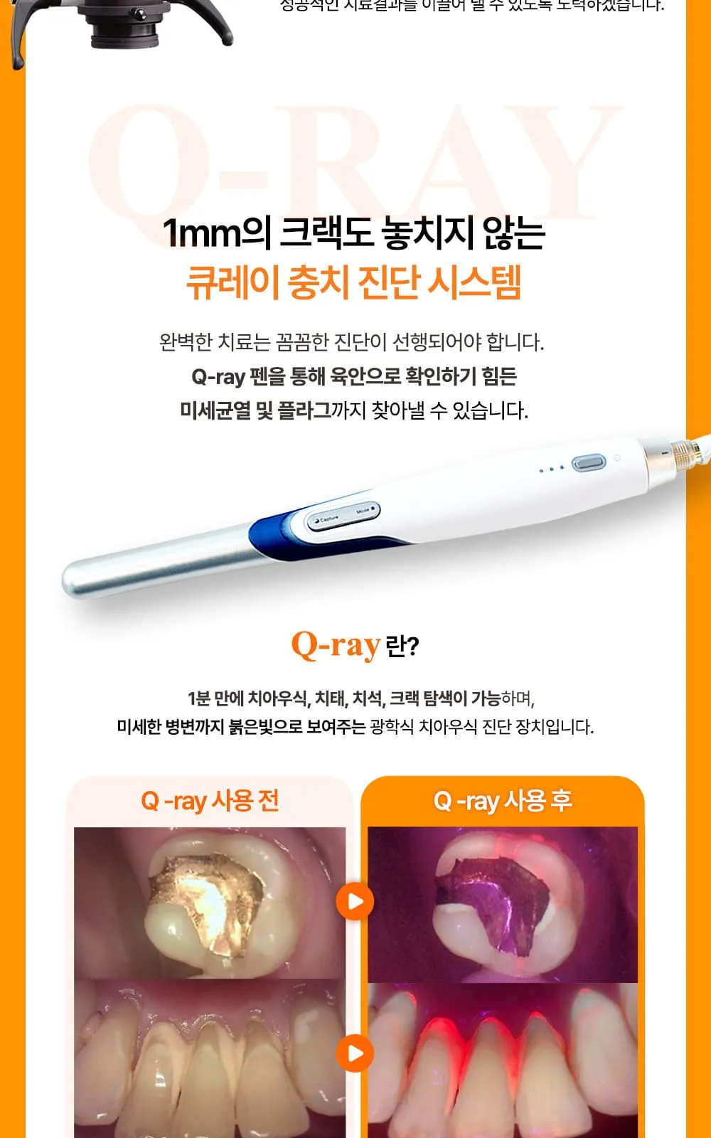 시술 상세 21