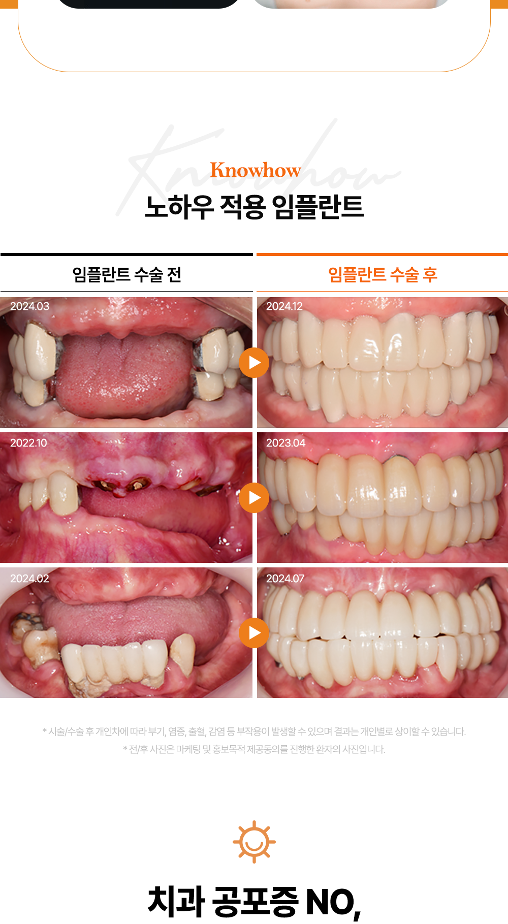 시술 상세 8