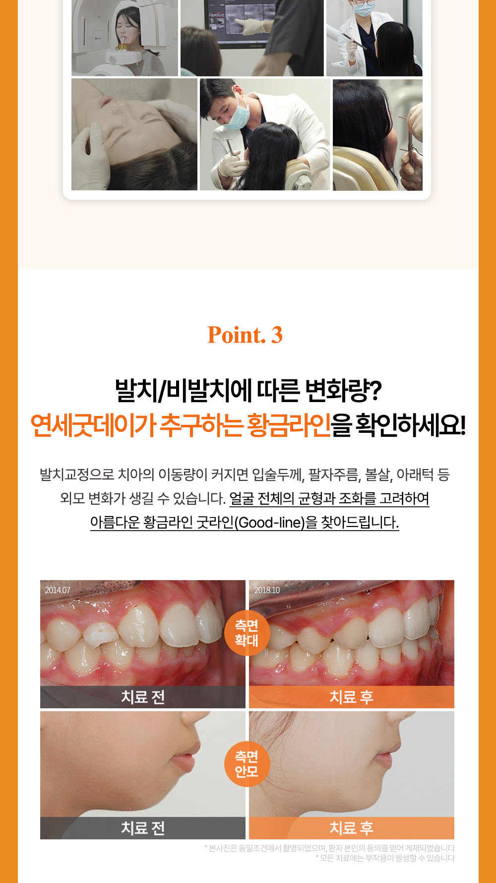시술 상세 13