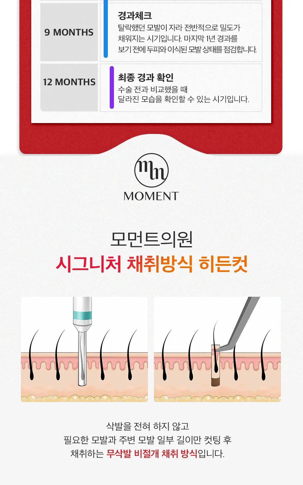 시술 상세 8