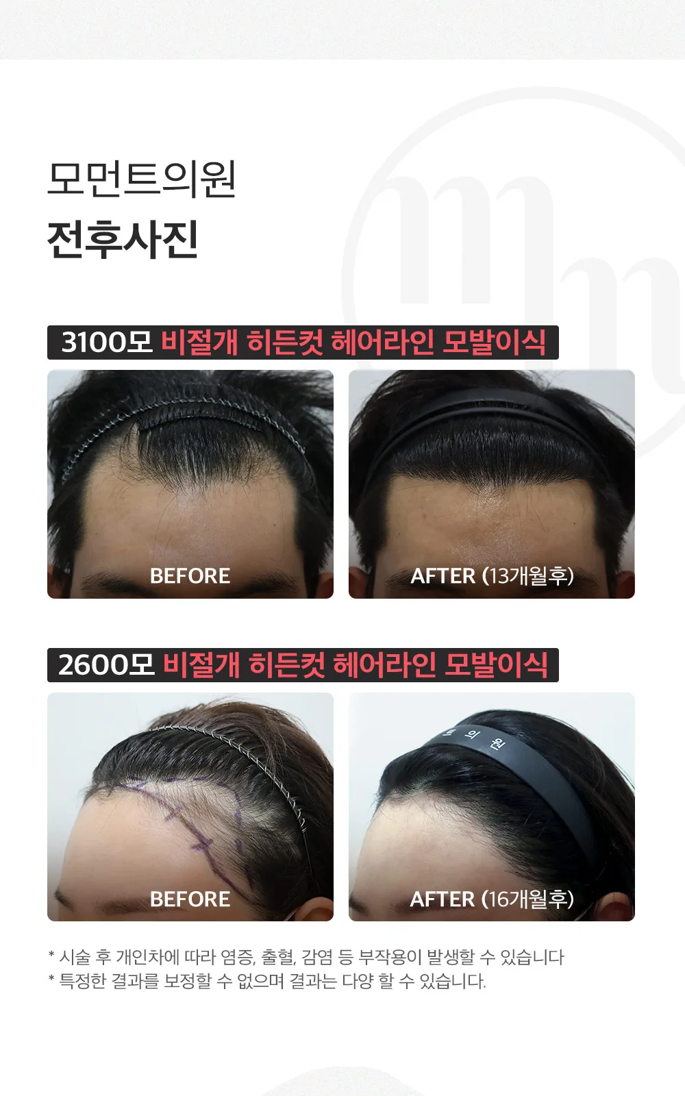 시술 상세 10