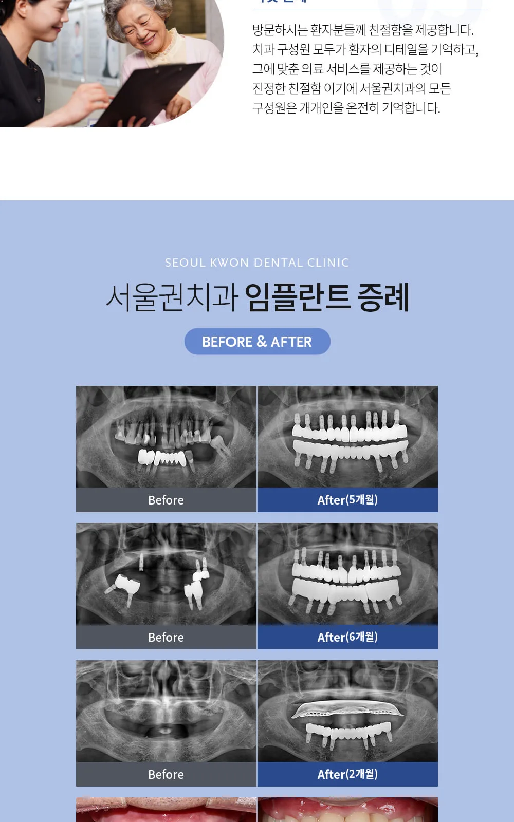시술 상세 5