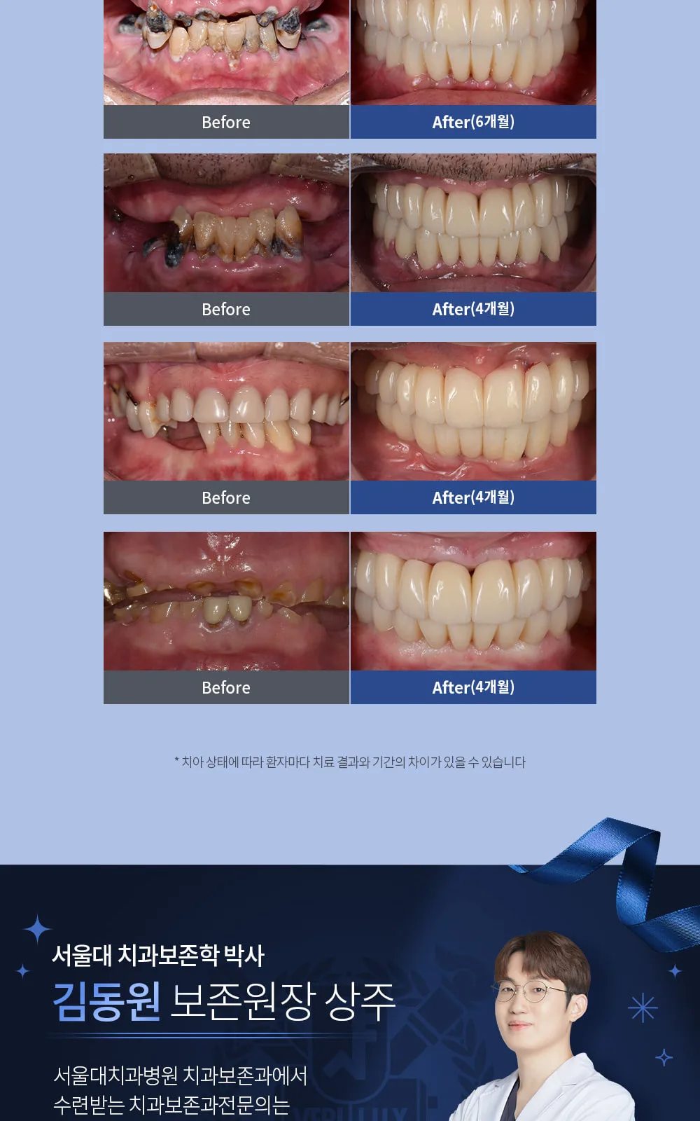 시술 상세 6