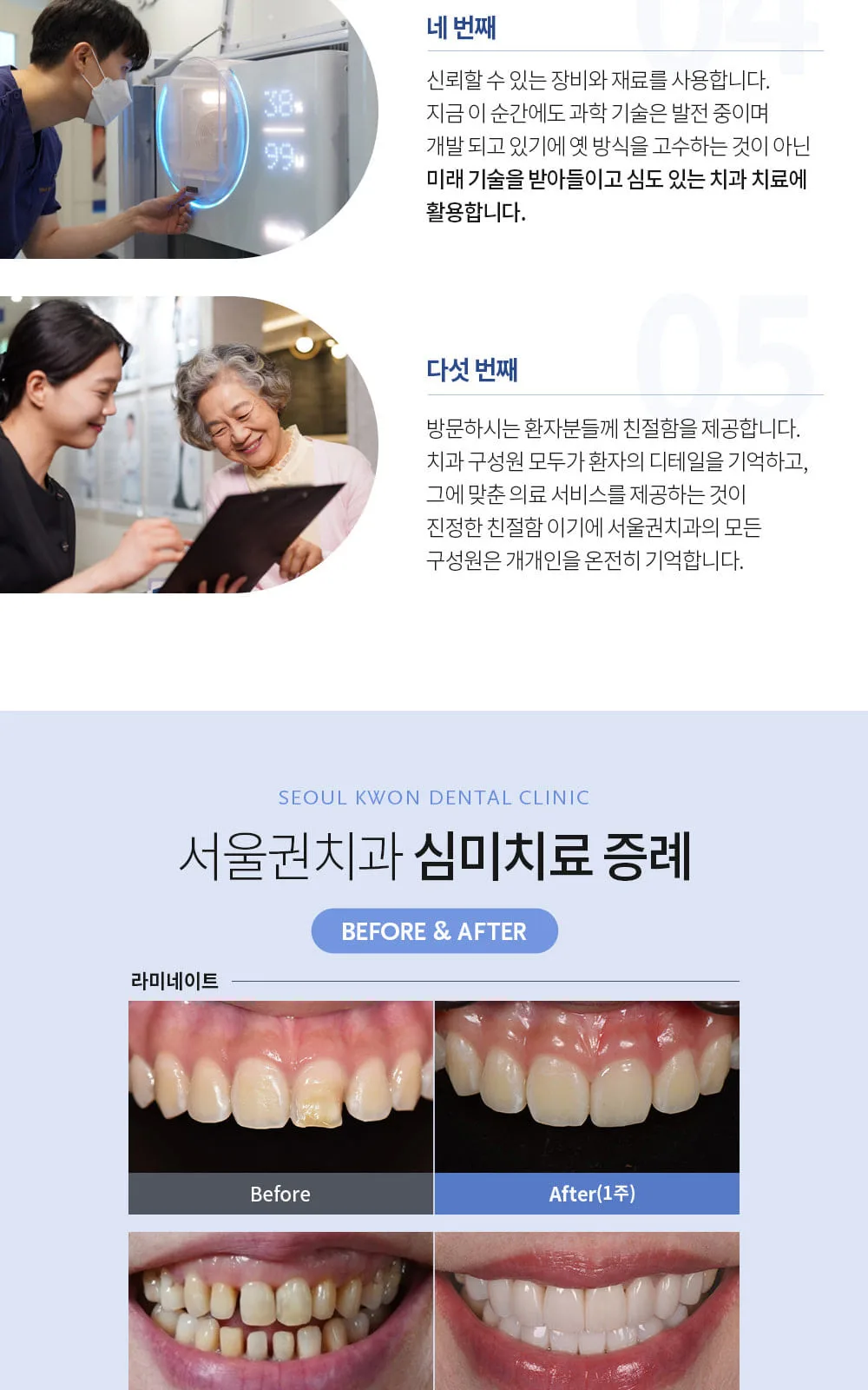 시술 상세 5
