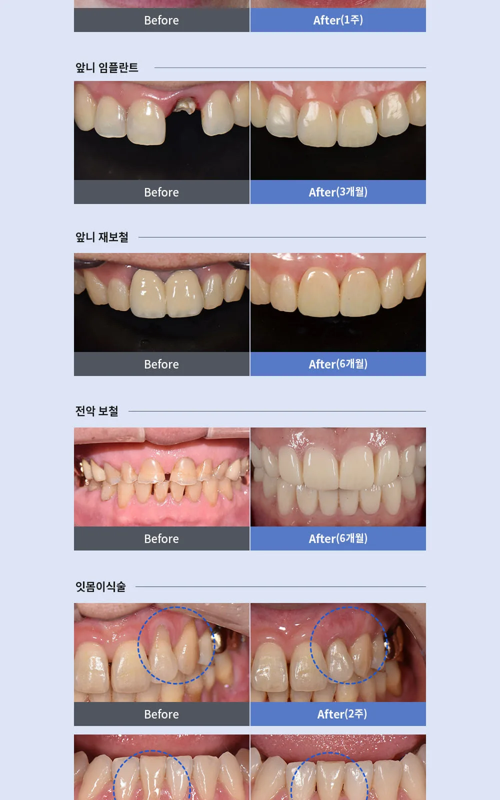 시술 상세 6