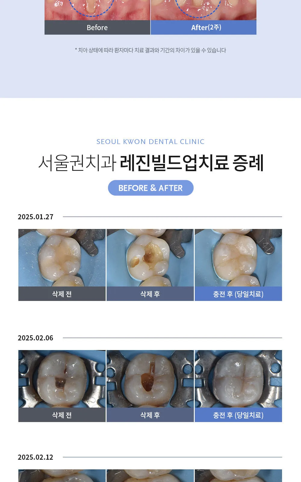 시술 상세 7