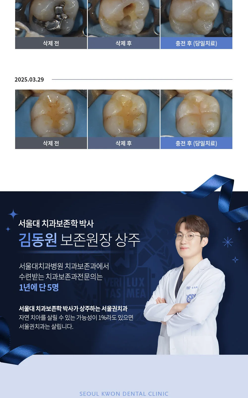 시술 상세 8