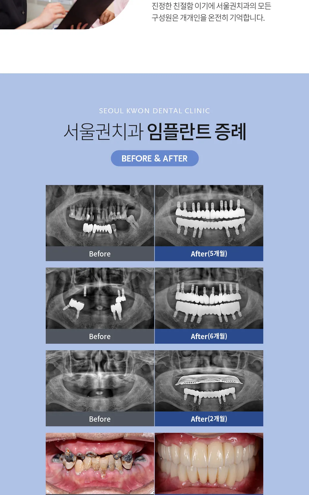 시술 상세 6