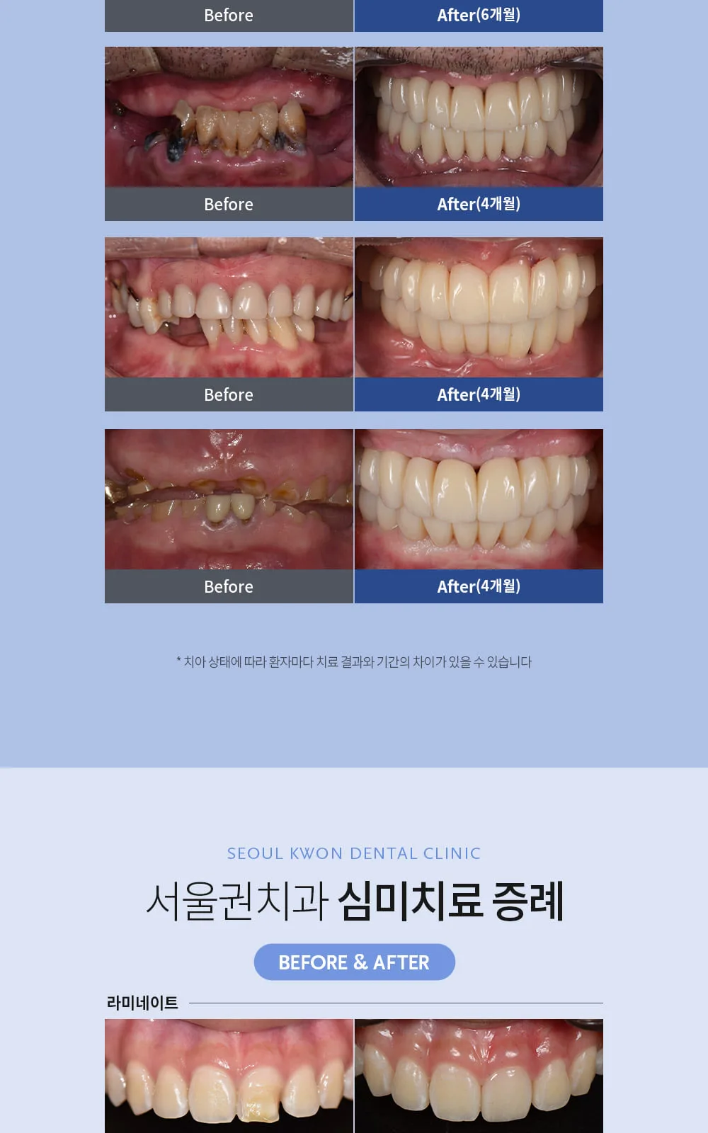 시술 상세 7