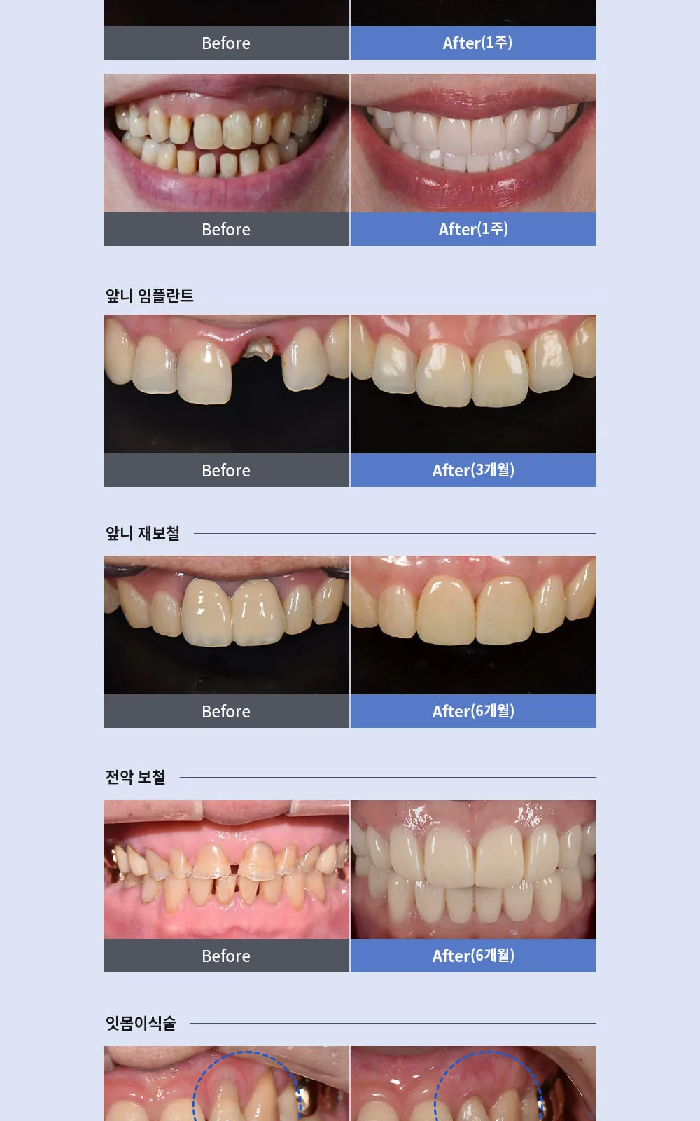시술 상세 8