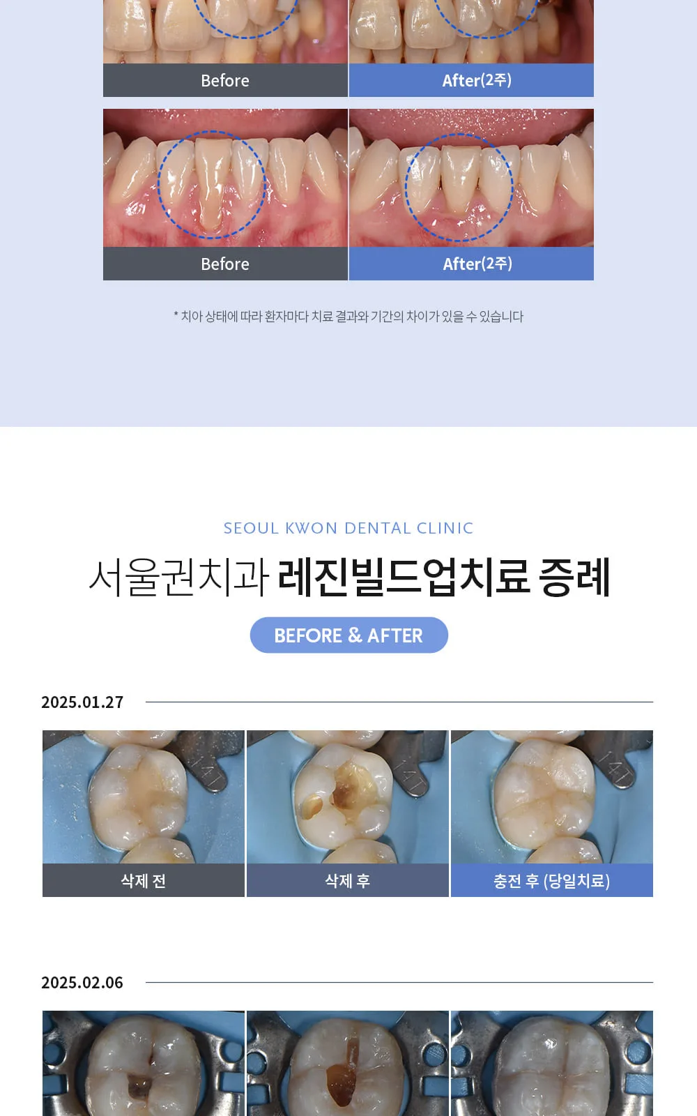 시술 상세 9