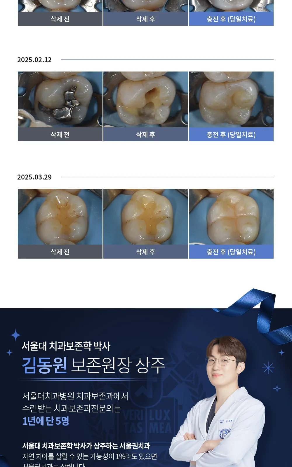 시술 상세 10