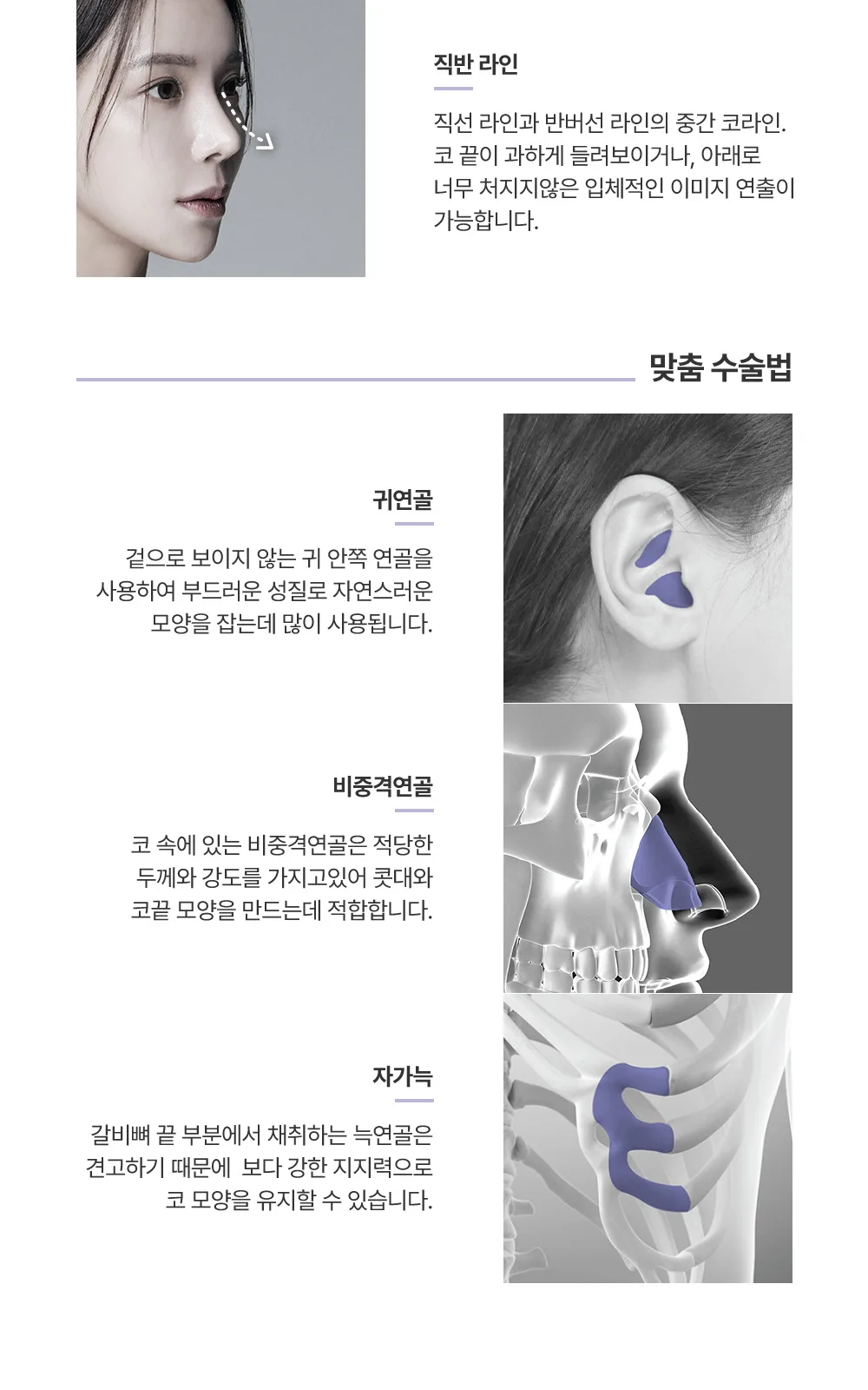 시술 상세 5