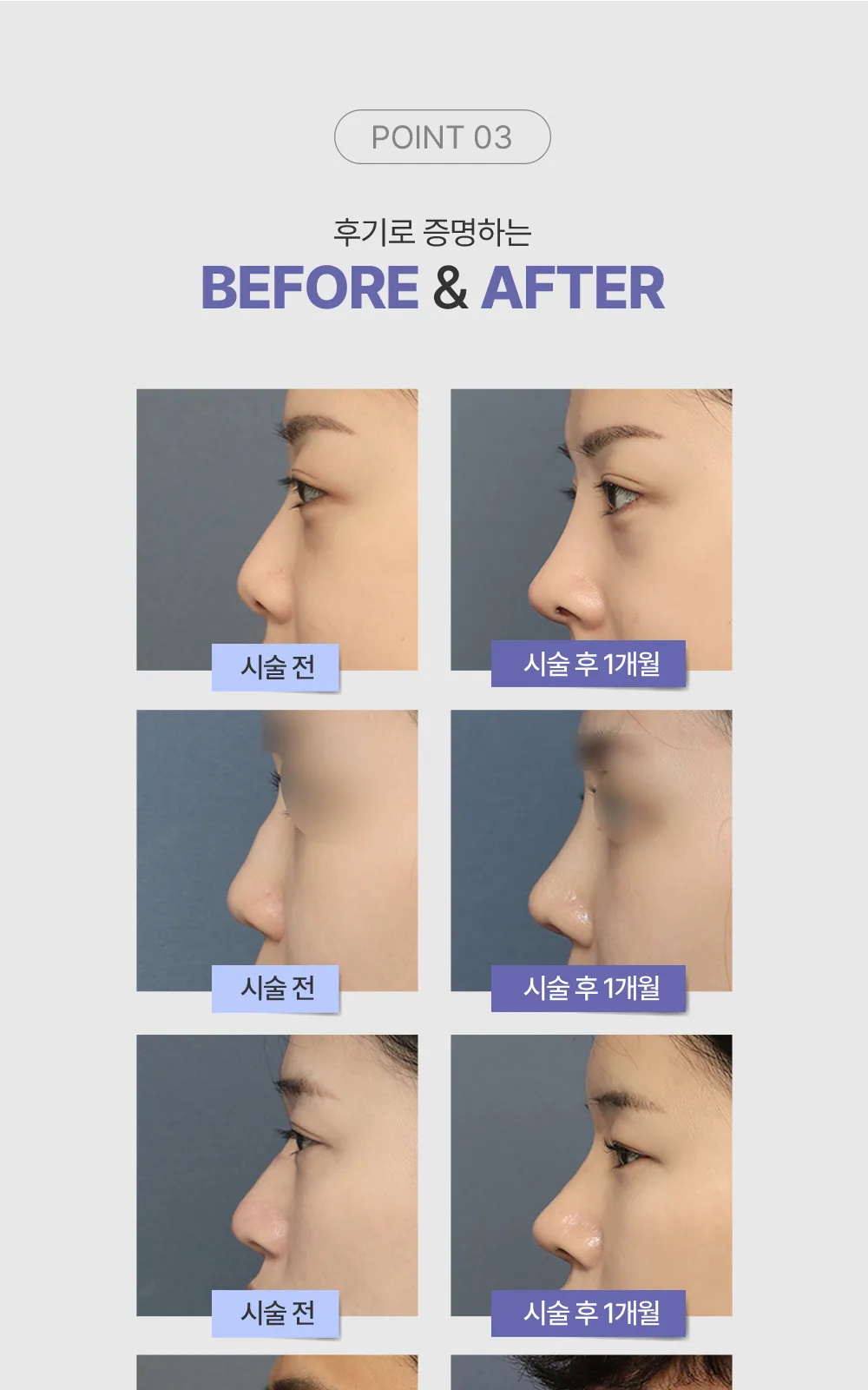 시술 상세 6