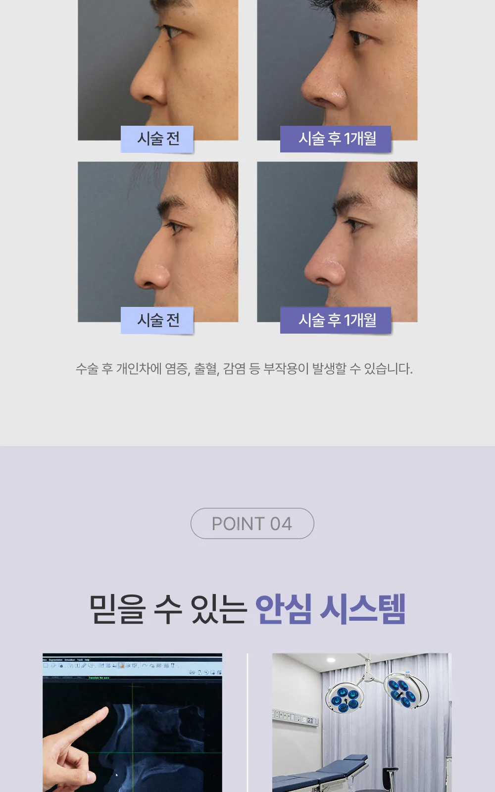 시술 상세 7