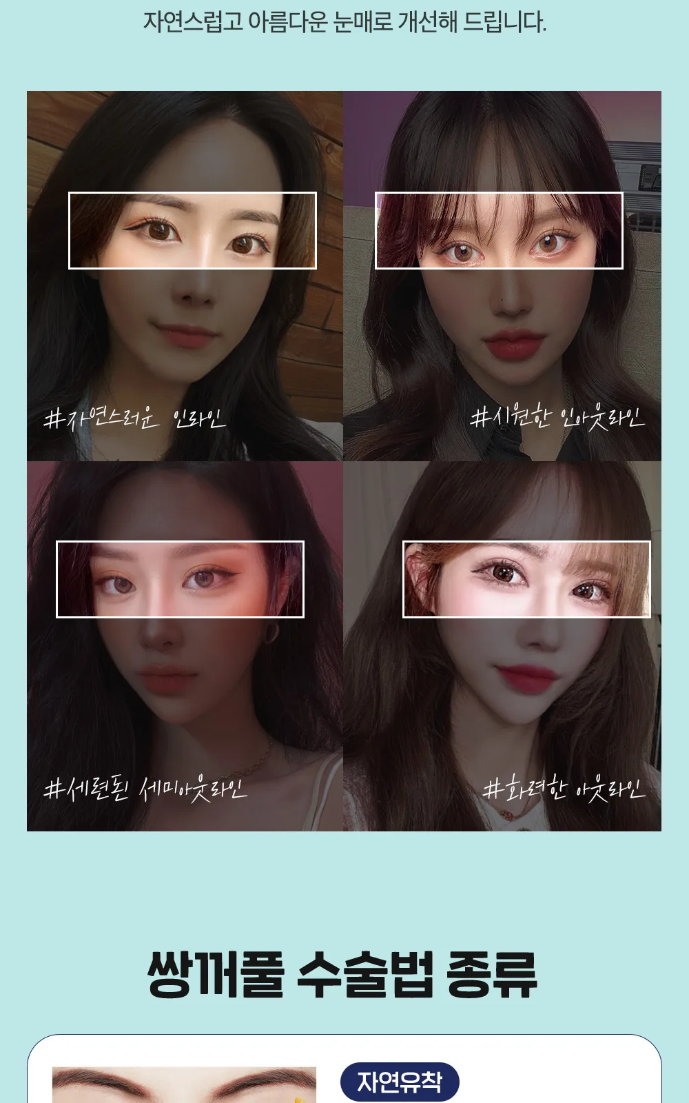 시술 상세 10