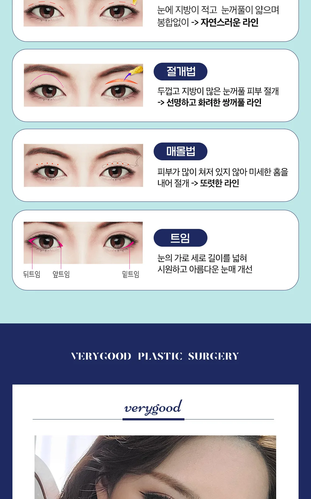 시술 상세 11
