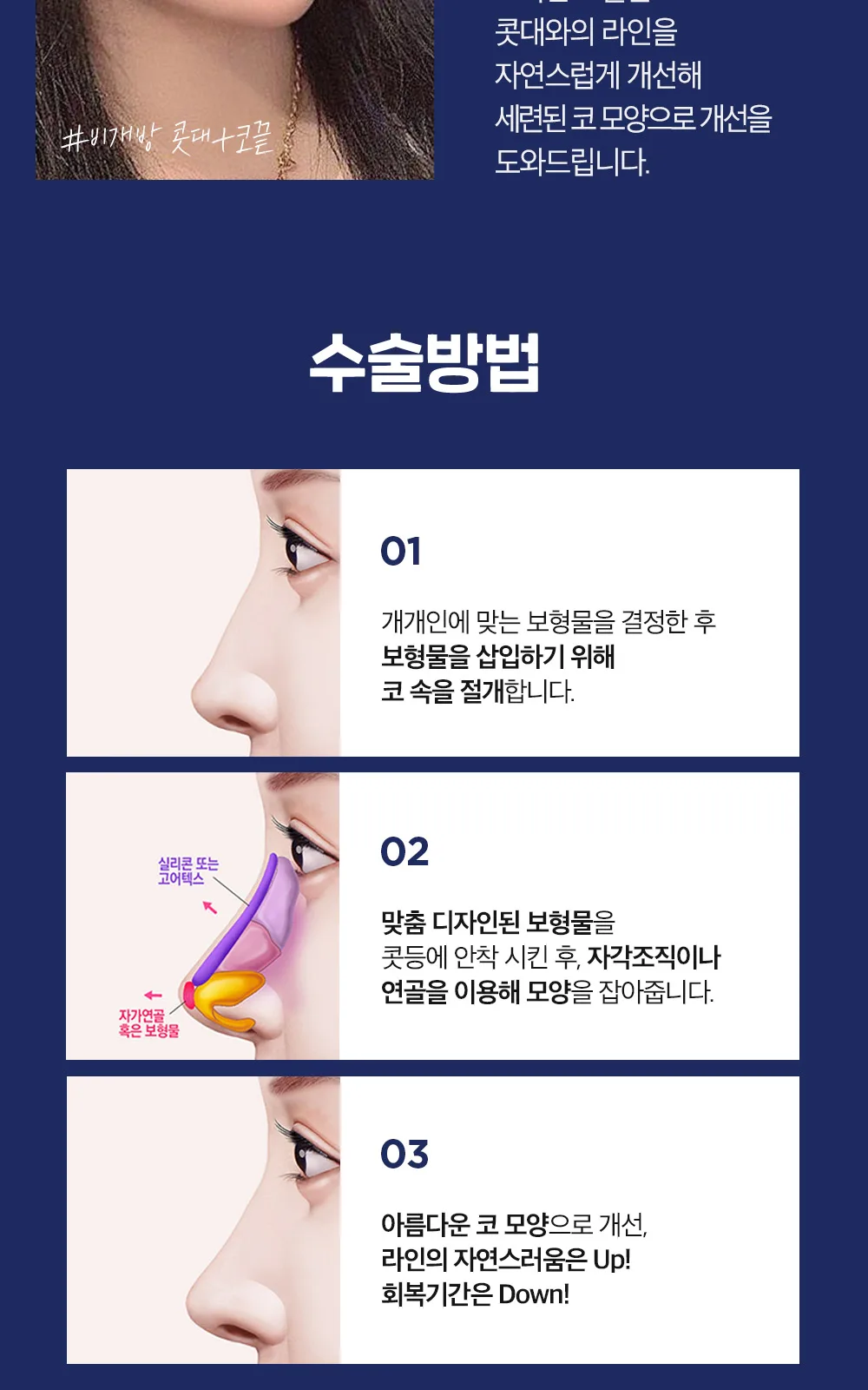 시술 상세 13