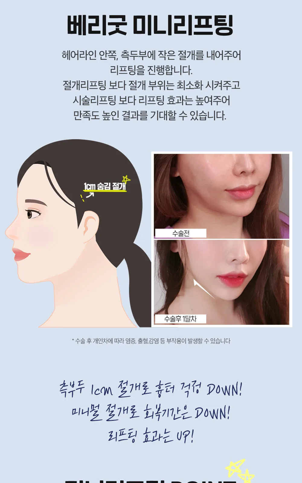 시술 상세 15