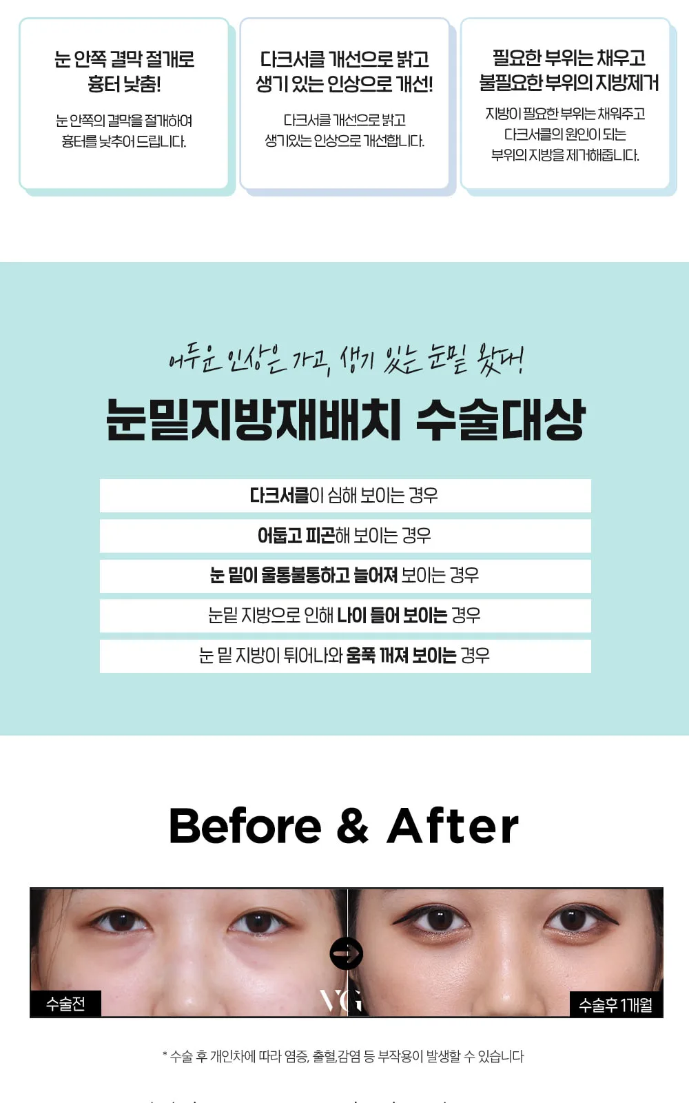 시술 상세 21