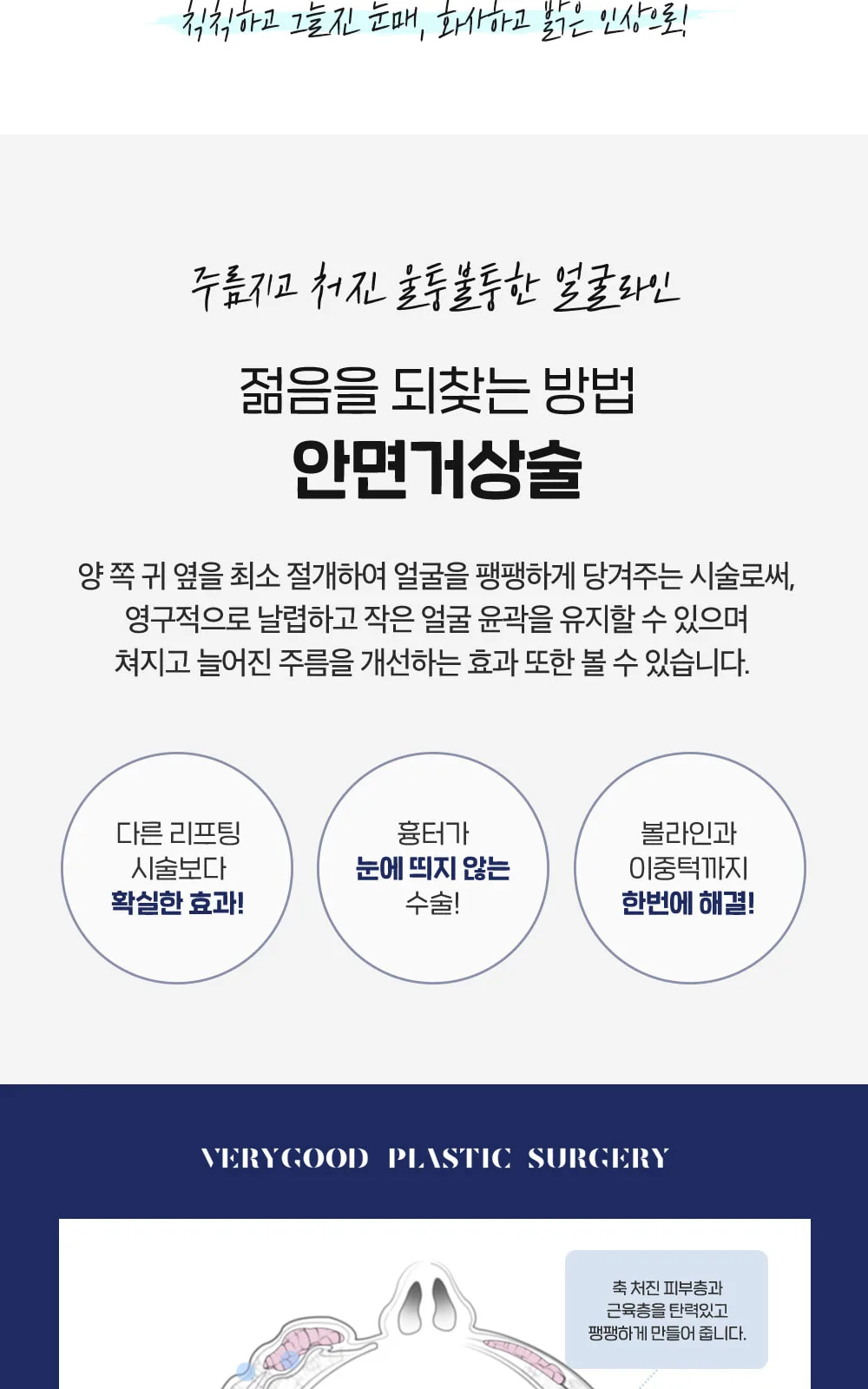 시술 상세 22