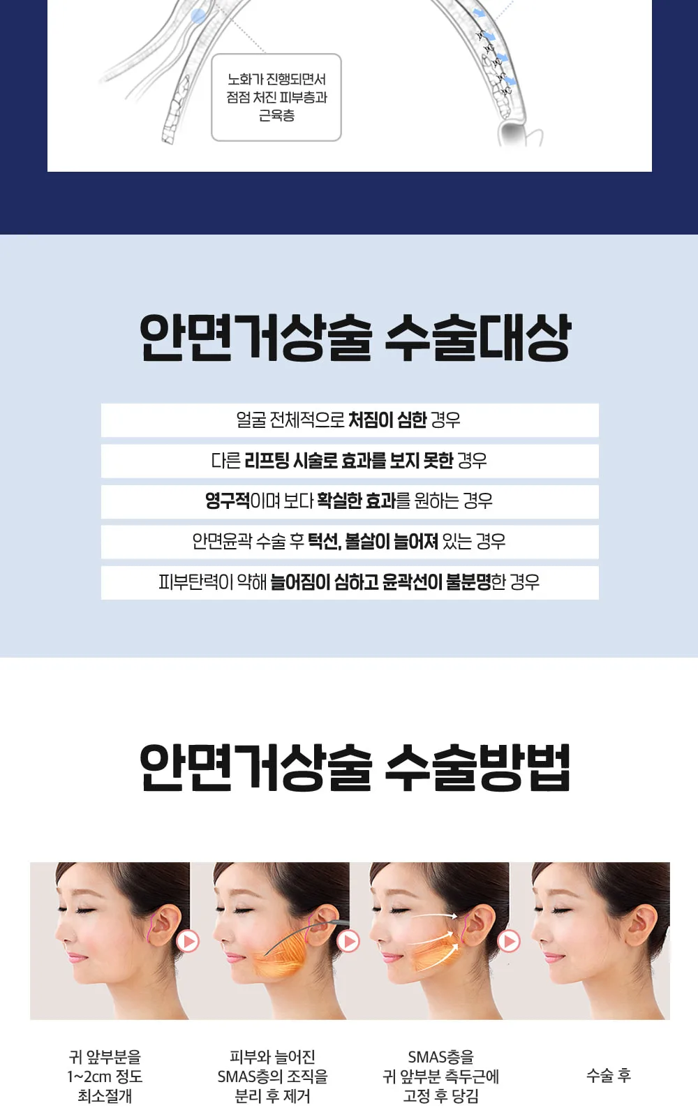 시술 상세 23