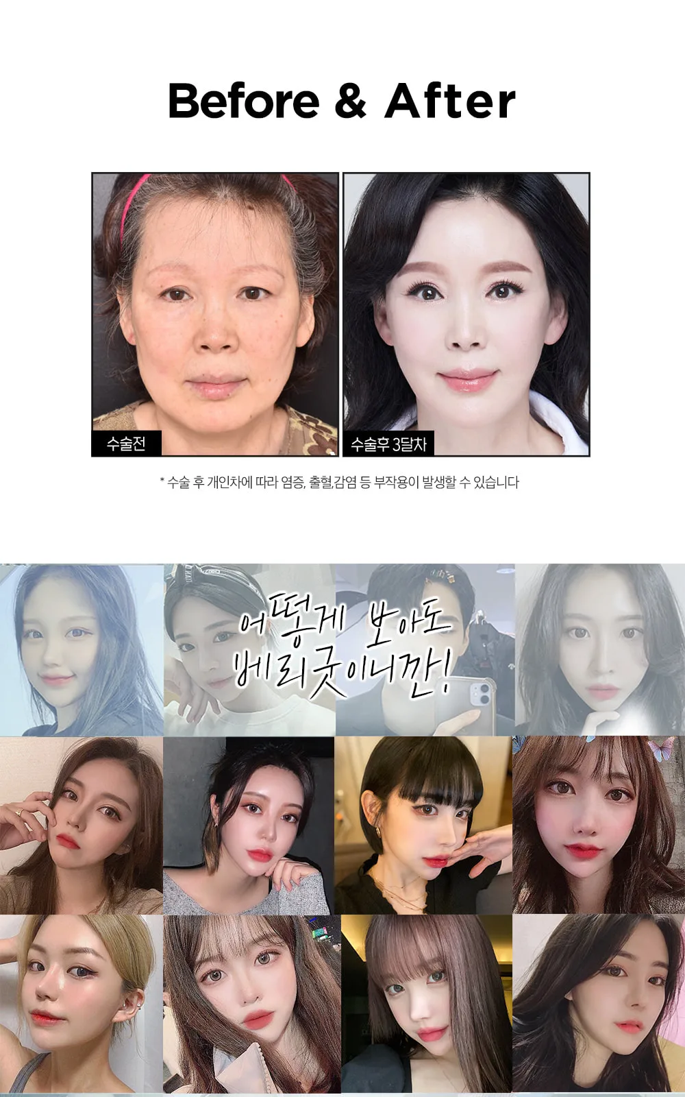 시술 상세 24