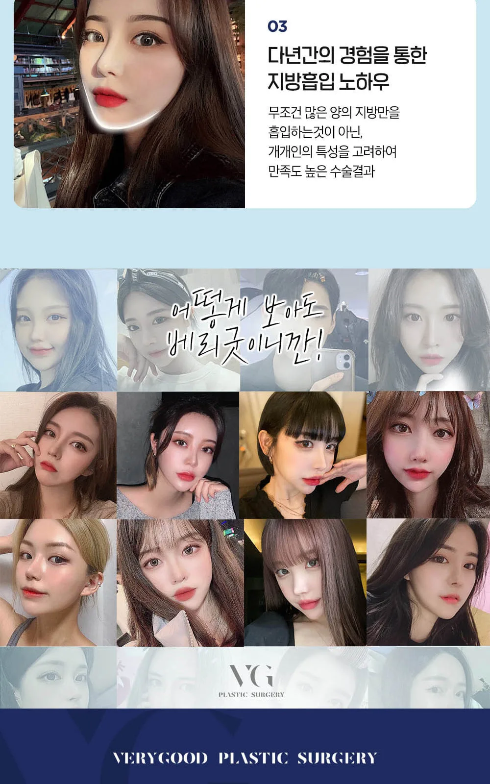 시술 상세 9