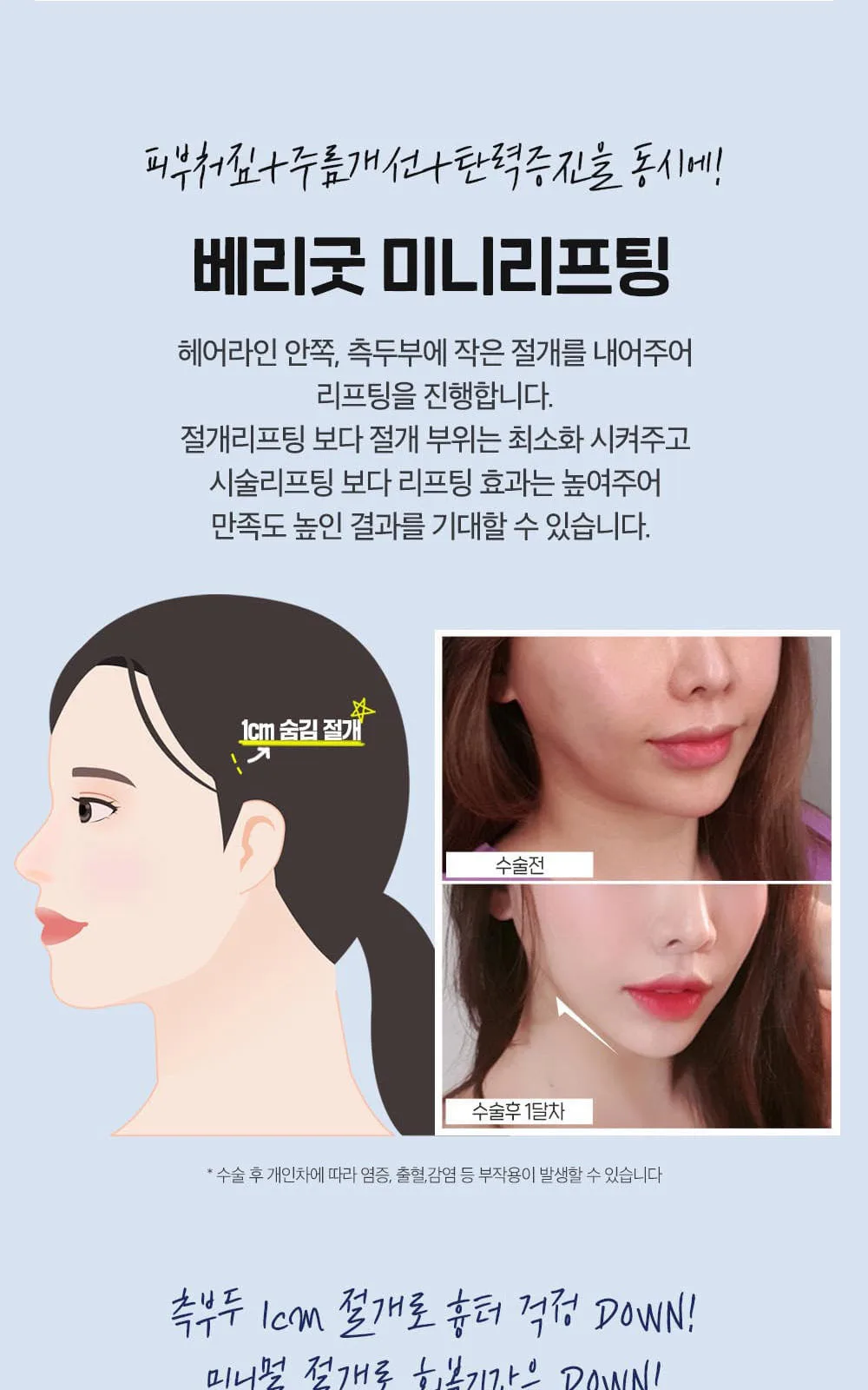 시술 상세 8