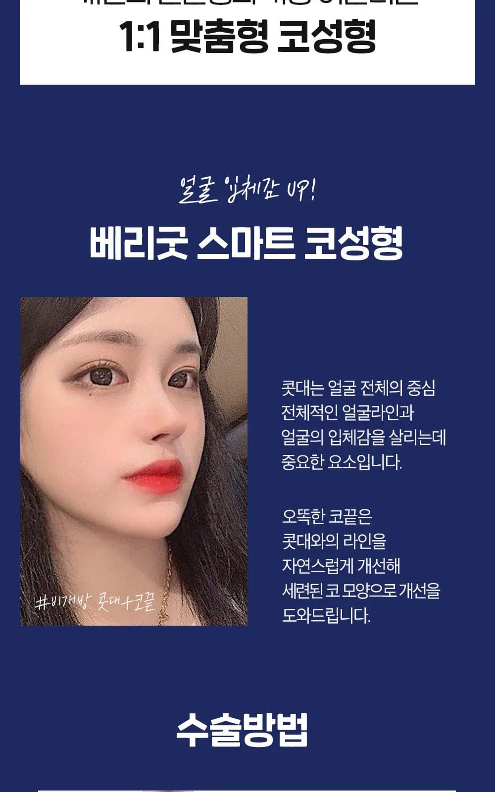 시술 상세 7