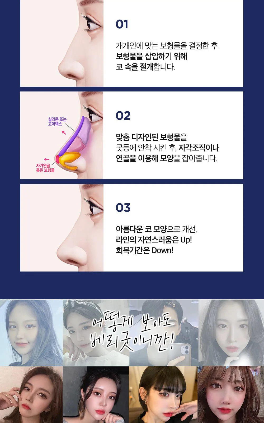 시술 상세 8