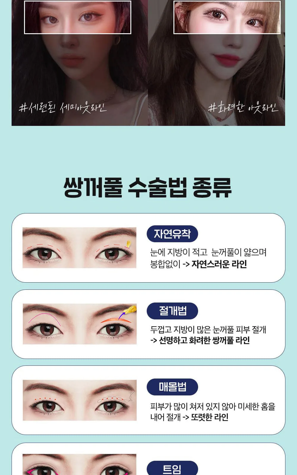 시술 상세 8