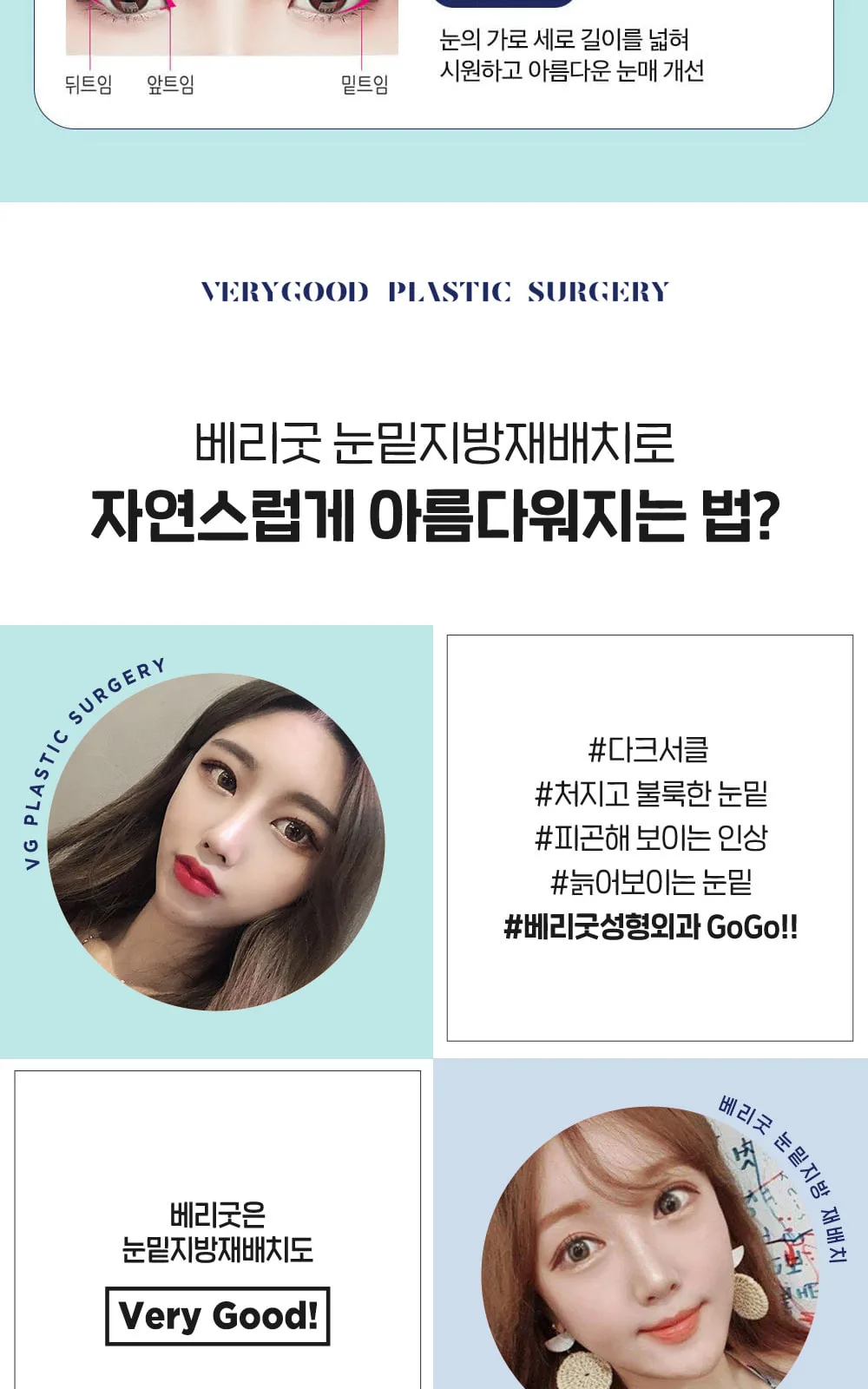 시술 상세 9